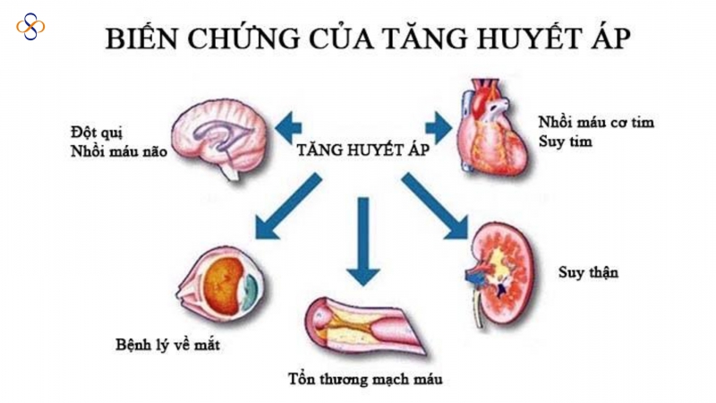 CẢI THIỆN SỨC KHỎE CHO NHỮNG NGƯỜI TĂNG HUYẾT ÁP 