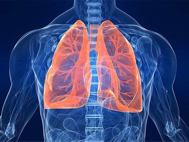 Lung cancer