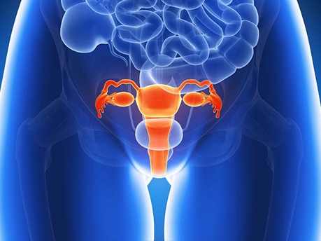 Ung thư cổ tử cung