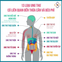 13 loại ung thư liên quan đến béo phì