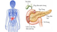 Hiểu biết cơ bản về ung thư tụy: Thông tin dành cho người bệnh