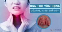 5 dấu hiệu tưởng cảm thông thường hóa ra đã mắc ung thư vòm họng